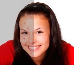 To remove pimples from your face photo to make online in a couple of clicks.